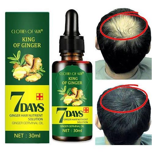 GINGER GERMINAL OIL for fast hair growth