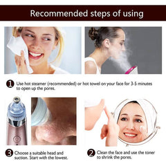 Imported Blackhead & Acne Pore Cleanser Removal kit